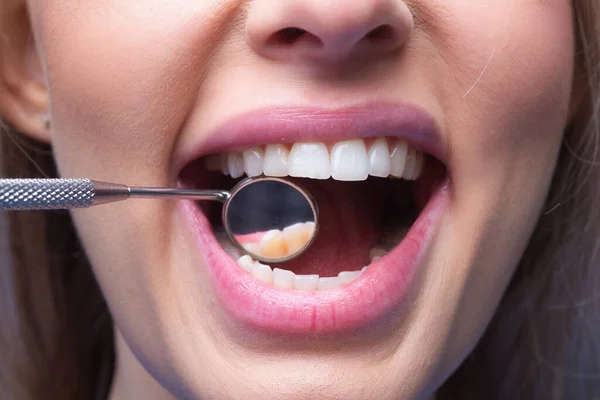 Zęby Dentysta Usta Lustro Zbliżenie Badanie Zębów Lusterkiem Dentystycznym Idealne — Zdjęcie stockowe