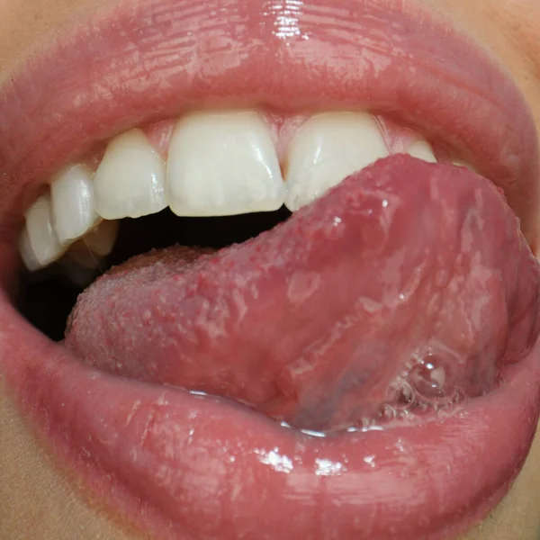 歯のケア 健康的な歯と笑顔 口の中で白い歯 白い健康な歯で笑顔の閉鎖 口を開けて舌が歯に触れる — ストック写真