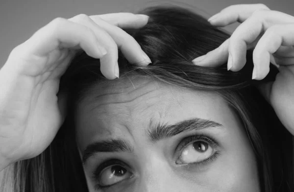 Kobieta Problemem Wypadania Włosów Portret Młodej Dziewczyny Łysiną Zdjęcie Nerwowej — Zdjęcie stockowe