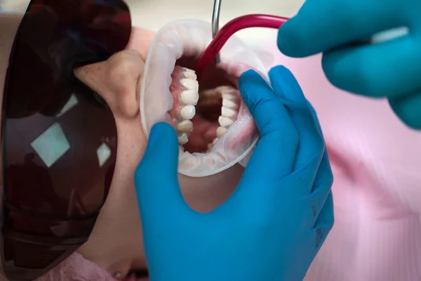 Ludzie Medycyna Stomatologia Koncepcji Opieki Zdrowotnej Zbliżenie Kobieta Dentysty Lusterko — Zdjęcie stockowe