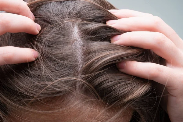 Zbliżenie Kobiety Badającej Jej Skórę Głowy Włosów Wypadanie Włosów Linii — Zdjęcie stockowe