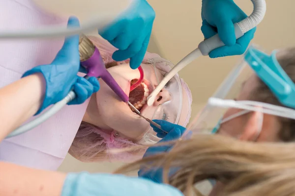 诊所牙医中一名女病人的特写镜头 年轻的金发碧眼的女性张开嘴 而无法辨认的牙医在乳胶手套检查她的牙齿的条件 — 图库照片