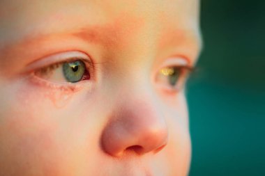 Gökyüzü mavisi gözlü sulu göz. Küçük hassas oğlan ağlıyor. Göz damlası, küçük tatlı çocuğun gözyaşı damlası. Duygusal bebek annesini özlüyor. Çocukluk kavramı