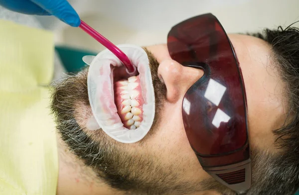 Стоматолог Вивчає Зуби Пацієнтів Клініці Відбілювання Зубів — стокове фото