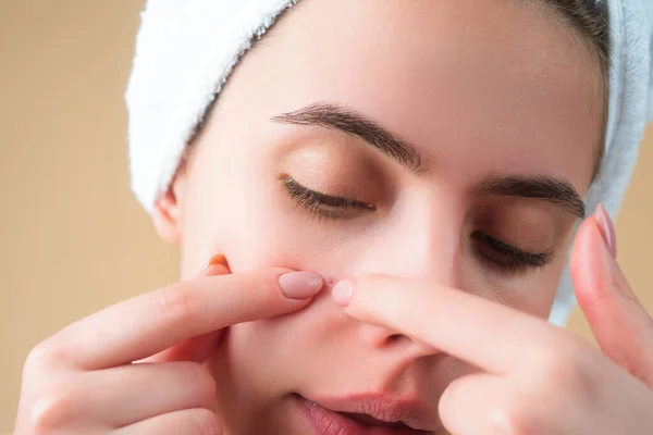 Pustule Acne Close Pimple Female Skin Dermatology Puberty Woman Skin — Stock Photo, Image