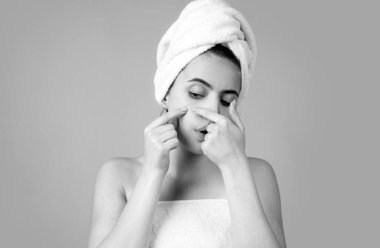 Yüzünde sivilce olan bir kadın. Sivilce lekeleri genç bir kadında deri lekesi. Benekli sivilce, çiller ve melasma pigmentasyonu yüz bakımı, sorunlu cilt konsepti.