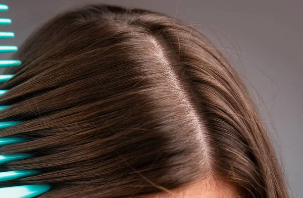 Close Problem Hair Macro Hair Care Hair Loss Concept — Stock Photo, Image