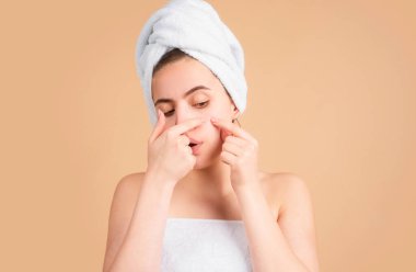 Yüzünde sivilce olan bir kadın. Sivilce lekeleri genç bir kadında deri lekesi. Benekli sivilce, çiller ve melasma pigmentasyonu yüz bakımı, sorunlu cilt konsepti.