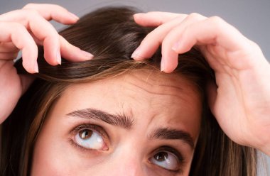 Saç dökülmesi sorunu olan bir kadın. Kel bir genç kızın portresi. Tedirgin bir kızın saç fırçasıyla kafasının fotoğrafı.