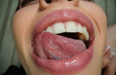 Gülen komik ağızlar. Mutluluk gülüşü ve ağız ikonu, neşeli gülümseme, insan duyguları konsepti. Mutlu kadın dudakları