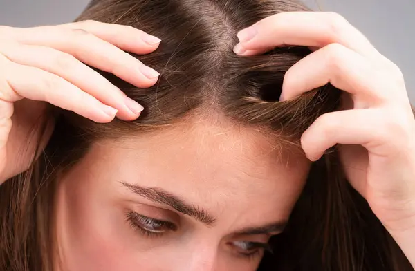 Smutná Žena Problémem Vypadávání Vlasů Obává Vypadávání Vlasů — Stock fotografie