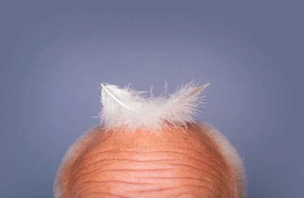 老人の頭を太字 年配の男性 健康問題 高齢化 脱毛と脱毛 — ストック写真