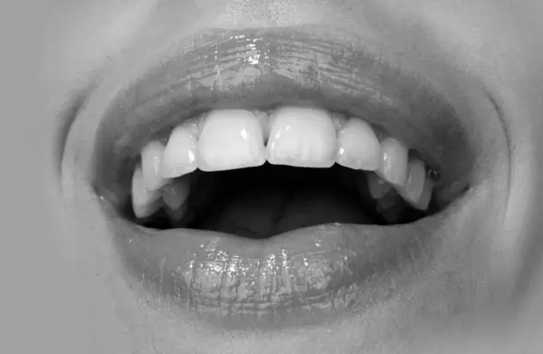 Dental care, healthy teeth and smile, white teeth in mouth. Closeup of smile with white healthy teeth. Smiling mouthes. Happiness laughing and enjoying mouth icon