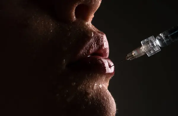 Dudak Büyütme Kadın Ağzı Şırıngası Hyaluronik Asit Enjeksiyonu Yaş Değişir — Stok fotoğraf