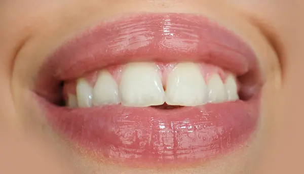 Dental care, healthy teeth and smile, white teeth in mouth. Closeup of smile with white healthy teeth. Open mouth