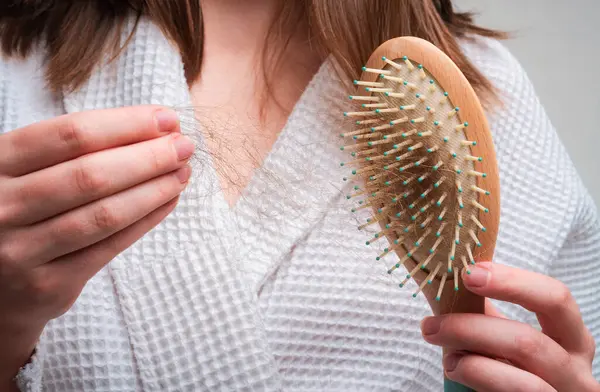 Concept Hair Loss Problem Hair Comb Isolated Damaged Unhealthy Hair — Stock Photo, Image