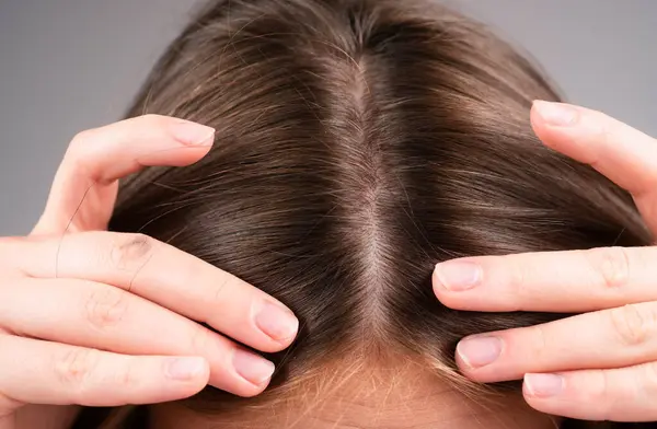 Woman Worried Hair Loss Hair Fall Problem — Stock Photo, Image