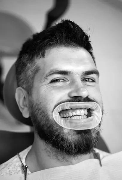 Schöne Europäische Mann Lächeln Mit Gesunden Zahnaufhellung Zahnarzt Beim Vergleich — Stockfoto