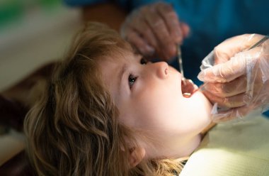 Diş hekimleri sağlık muayenesi. Diş muayenehanesinde dişçisi olan bir çocuk. Diş hekimi hasta çocuk dişlerini kontrol ediyor. Çocuk dişlerinin yakın plan dişçi prosedürü