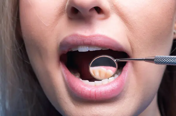 Los Dientes Del Dentista Miran Cerca Examen Dientes Con Espejo — Foto de Stock
