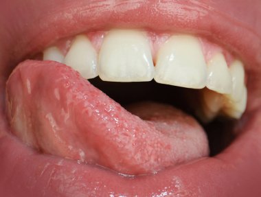 Diş bakımı, sağlıklı dişler ve gülümseme, ağzında beyaz dişler. Sağlıklı beyaz dişlerle gülümseme. Ağzını aç, dil dişlere değsin. Aşırı kapalı ağız, makro seksi dudak