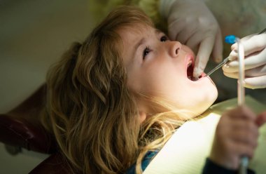 Çocuk dişlerinin yakın plan dişçi prosedürü. Diş hekiminde küçük çocukların dişlerini muayene eden bir diş hekimi.