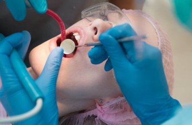 Güzel genç kadın beyaz arka plan sağlıklı dişlere sahip. Bir kadın hasta ziyaret dişçi klinikte diş beyazlatma için yakın çekim portre. Diş Bakımı kavramı