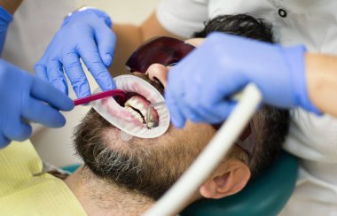 Diş bakımı düzenli diş beyazlatmayı da içeriyor. Beyazlatma işlemi diş sağlığı ve dişleri geliştirir. Diş hijyeni diş beyazlatma ile başlar. Diş beyazlatıcıdan sonra dişler daha sağlıklı görünür.