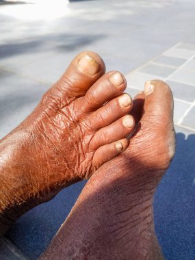 Hindistan 'da yaşlı bir kadının sert ayaklarının yakın çekimi.