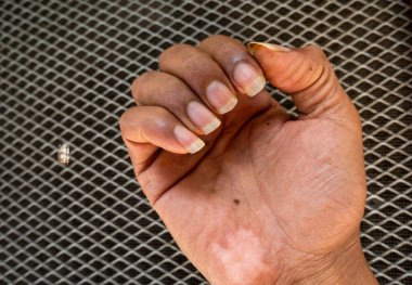 14 Ekim 2022 Uttarakhand, Hindistan. Hintli bir yetişkinin elindeki makro kesilmiş tırnaklar. Vücut hijyeni farkındalığı kavramı