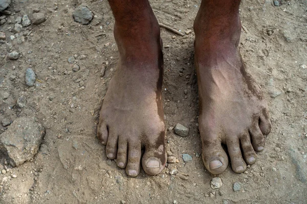 Close-up of Indian male feet, immersed in mud and soil for natural organic therapy, practicing barefoot walking in India.
