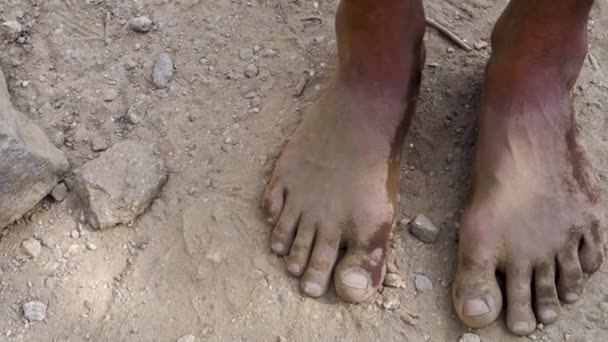 在印度 为进行自然有机疗法而在泥巴和土壤中浸泡 赤脚行走的印度男足的特写 — 图库视频影像