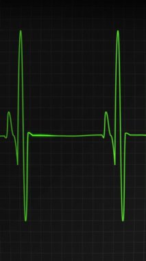 EKG EKG Ekran GörüntüleyiciComment