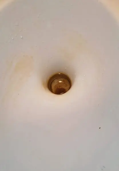 Lekeler klozetin içine gömülmüş..