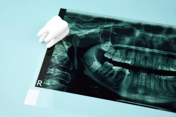 Panoramic snapshot of the jaw the patient\'s tooth on a light blue background.