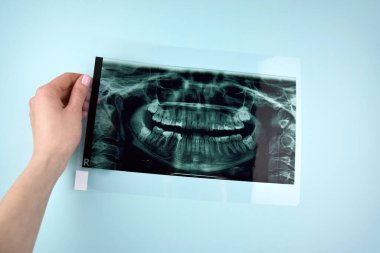 Hastanın dişini çeken bir dişçi. Açık mavi arkaplan üzerinde çene panoramik çekim.