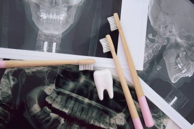 Çenenin panoramik görüntüsü hastanın dişleri açık mavi arkaplanda.