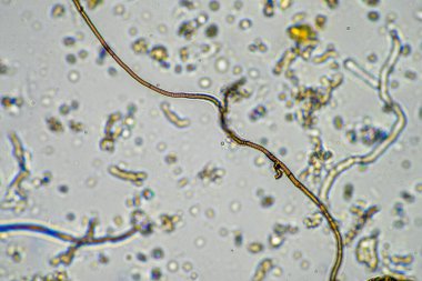 mikroskop altında toprak örneği. toprak mantarları ve mikroorganizmalar ilkbaharda gübre içinde besinleri döngüye geçirirler