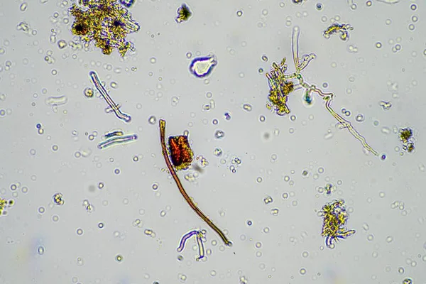 显微镜下的土壤样品 春季堆肥中土壤真菌和微生物循环养分 — 图库照片