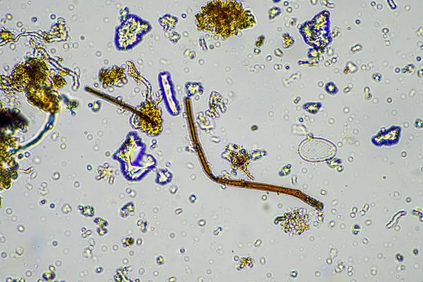 Vzorek Půdy Pod Mikroskopem Půdní Houby Mikroorganismy Cyklické Živiny Kompostu — Stock fotografie