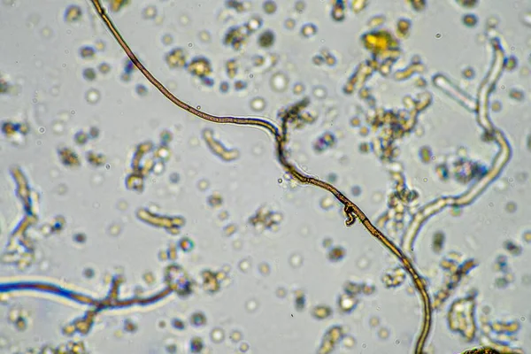 Próbka Gleby Pod Mikroskopem Grzyby Glebowe Mikroorganizmy Krążące Wiosną Składnikach — Zdjęcie stockowe