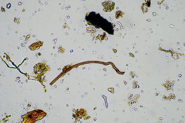 Bodemmonster Onder Microscoop Bodemschimmels Micro Organismen Die Het Voorjaar Voedingsstoffen — Stockfoto