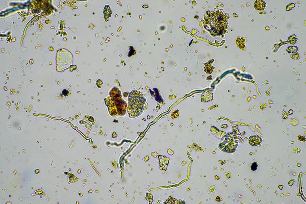 Bodemmonster Onder Microscoop Bodemschimmels Micro Organismen Die Het Voorjaar Voedingsstoffen — Stockfoto