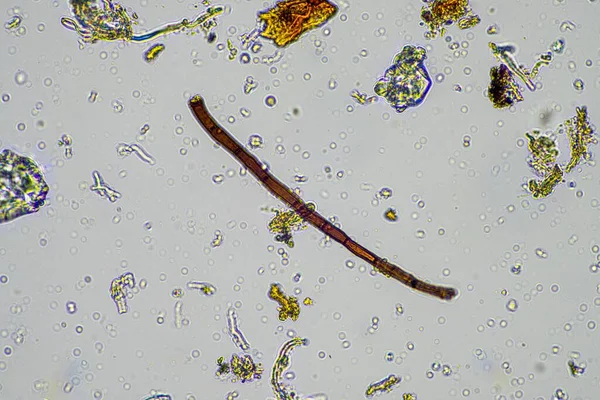 soil sample under the microscope. soil fungi and microorganisms cycling nutrients in compost in spring