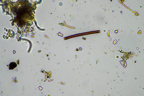 Micro Organismen Bodembiologie Met Nematoden Schimmels Onder Microscoop Een Bodem — Stockfoto
