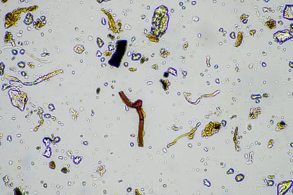 显微镜下的土壤样品 春季堆肥中土壤真菌和微生物循环养分 — 图库照片