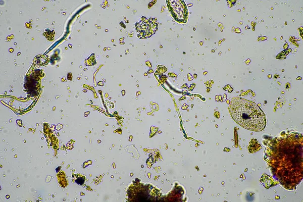 Мікроорганізми Ґрунтознавство Нематодами Грибами Під Мікроскопом Грунті Компості Зразка Навесні — стокове фото