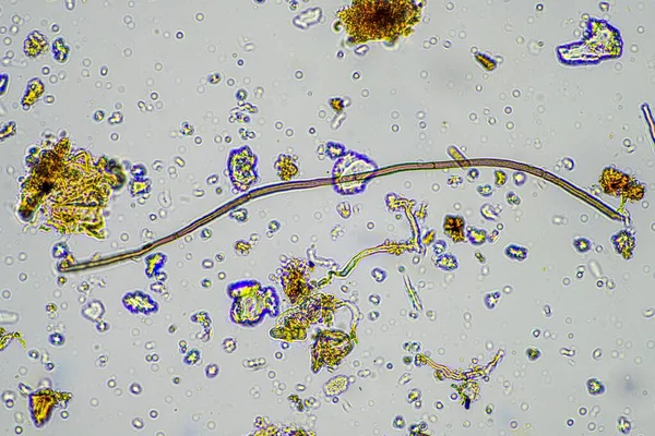 Δείγμα Εδάφους Κάτω Από Μικροσκόπιο Μύκητες Του Εδάφους Και Μικροοργανισμοί — Φωτογραφία Αρχείου
