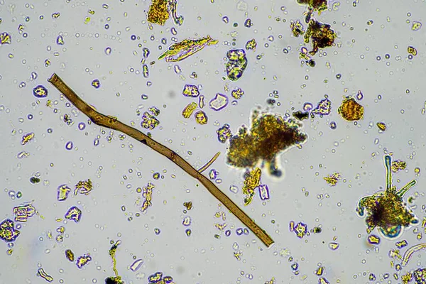 微生物和土壤生物 显微镜下有线虫和真菌 在土壤和堆肥样本中的春天 — 图库照片
