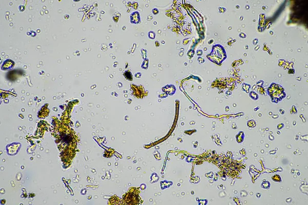 Fungal and fungi hyphae under the microscope in the soil and compost, in a soil biology and microorganism test in Australia in spring